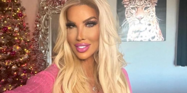 90 Day Fiance Million Dollar Barbie ‘nikki Exotica Gets Another Cosmetic Surgery Tlc News 
